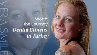 Worth the Journey: Dental Crowns in Turkey | #dentalcosmetics #dentalclinicturkey