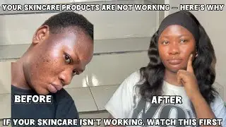 Why Your Skincare Is Not Working (You’re Making These Mistakes)
