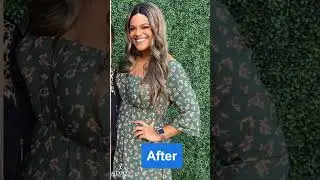 How bariatric surgery changed my life!
