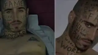 D Ink Laser Tattoo Removal albuquerque