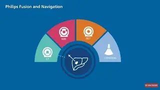 Philips Ultrasound Fusion and Navigation Value Proposition