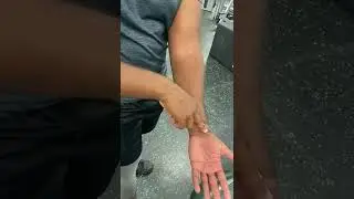 Radial pulse demonstration