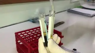 Coleta, centrifugação e separação de plasma citratado.