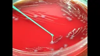🤒 Łykasz żelazo podczas infekcji? Będziesz chorował dłużej i ciężej!
