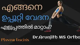 ഉപ്പൂറ്റി കണങ്കാൽ വേദന പൂർണമായും മാറും ഇങ്ങനെ ചെയ്യ്താൽ! Everything on plantar fascitis & exercise