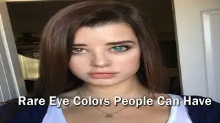 Rare Eye Colors People Can Have | Why People Don't Have Black Eyes | what is the rarest eye color