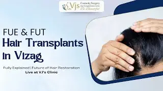 FUE & FUT Hair Transplant in Vizag Fully Explained | Future of Hair Restoration Live at VJ&rsquo;s Clinic