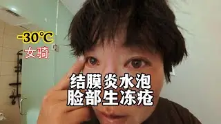 病倒了！阿里无人区冬季环境太恶劣了，女骑没扛住病倒了