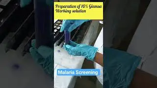 From field to microscope&ndash;fever survey for malaria detection using RDT &blood smears🦟🔬#Malaria#shorts