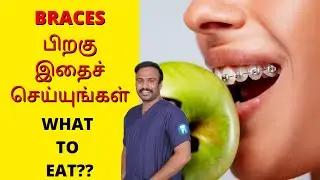 Tips to Maintain Your Braces | What to do After Dental Braces | Best Orthodontist in Chennai | Tamil
