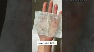 Nose patch oil/sebum removing test👃 #glamup #hydrocolloidpatches #blackheads #blackheadremoval