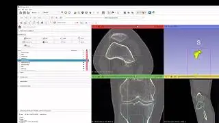 Tutorial 5 CT3D landmark 1/2