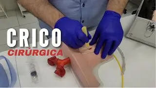 Cricotireoidostomia Cirúrgica - Técnica Completa