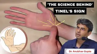 Understanding Tinel&rsquo;s Sign & Its Clinical Significance | Dr. Anubhav Gupta