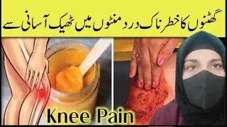 Knee Pain Prevention & Natural Treatment|Fast Relief Tips, Causes & Remedies(Scientifically Proven)