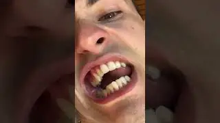 INSANE 90&deg; TONGUE ROLL 🔥