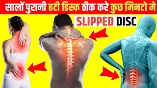 Slip Disc EXERCISE || 101% स्लिप डिस्क का इलाज #slipdisc #backpain #discpain 