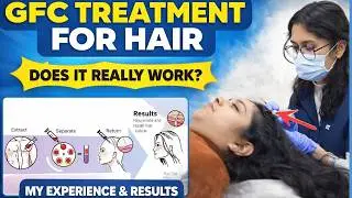 GFC Treatment for Hair Loss 💉 | Advanced Hair Regrowth Without Surgery | Skinfinity Derma