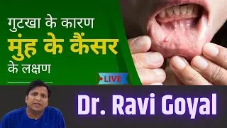 🔴 Gutka खाने से मुह में कैंसर कैसे होता है? जानें असली वजह Dr. Ravi Goyal से...