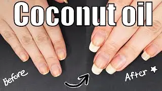 How To Grow Your Nails Long FAST with coconut oil!🥥￼