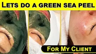 Green Sea Peel Facial for My Client | Beloria Academy