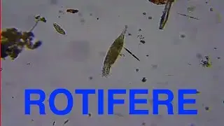 Rotif&egrave;re (Microscope x170)
