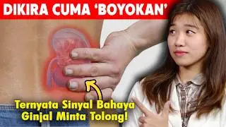 Dikira Sakit Pinggang Ternyata Ginjal Rusak? Kenali 4 Perbedaannya di Sini!