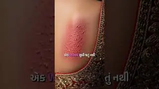 Glam Look, Painful Skin &mdash; Real Wedding Side Effect