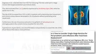 Gold standard treatment for PJI - Dr Kalaivanan Kanniyan