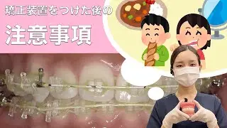 【必見！】矯正装置をつけた後の注意事項【何に気をつけるべき？】