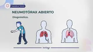 Clase de Medicina: Traumatismo torácico / Curso ENARM