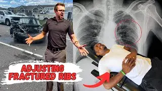 Adjusting Fractured Ribs | Dr Randy Cracks