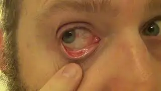 My Eyes