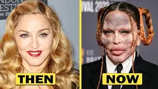 15 Celebrities Who Aged Horribly | Then and Now 2026