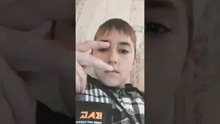 спалил лицо как и обещал
