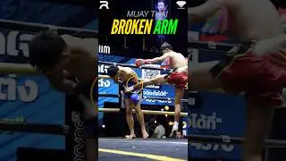 Strike Breaks Arm In Muay Thai Fight