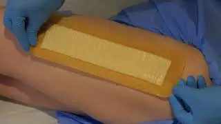 AQUACEL Surgical post-op dressing application on a hip