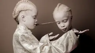 The Utterly Unique Appearance of These Twins Has Stunned the Internet