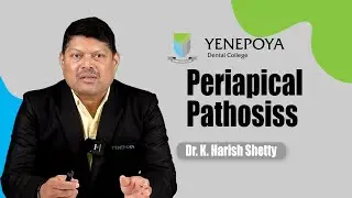 Periapical Diseases | Conservative Dentistry & Endodontics | YDC