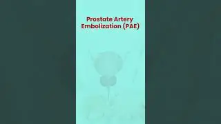 Dr. Neeraj Shetty | Vascular & Interventional Radiologist Thane | Prostate Artery Embolization (PAE)