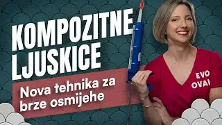 KOMPOZITNE INJECTABLE LJUSKICE - jeftinije i brže od keramičkih. No tko je kandidat, a tko ne?