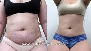 ULTRACOOL LIPO - CRIOMODELACI&Oacute;N AVANZADA