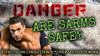Are SARMS Safe??? Complete Explanation of the Safety and Potential Dangers of SARMS!!!