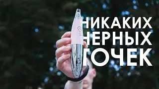 КРАТКО об InFace Blackhead Remover MS7000 - аппарате для вакуумной чистки лица