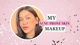 How I Cover Acne Flawlessly (No Cakey Look!) | Step-by-Step Routine