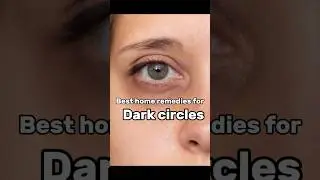 &ldquo;Say Goodbye to Dark Circles Naturally | Best Home Remedies ✨ #darkcircles #shorts