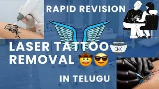 Laser Tattoo Removal Explained Step by Step | Science, Safety & Results ! RAPID REVISION in TELUGU