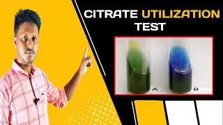 Citrate Utilization Test in Bangla | Citrate Utilization Test For Microbiology