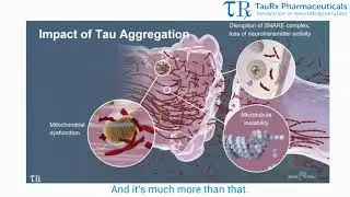 Tau and the Aging Brain Part 2 - The Brain and Tau Pathology Mini Series
