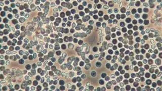 Exflagellation of microgametocytes - Plasmodium yoelii nigeriensis